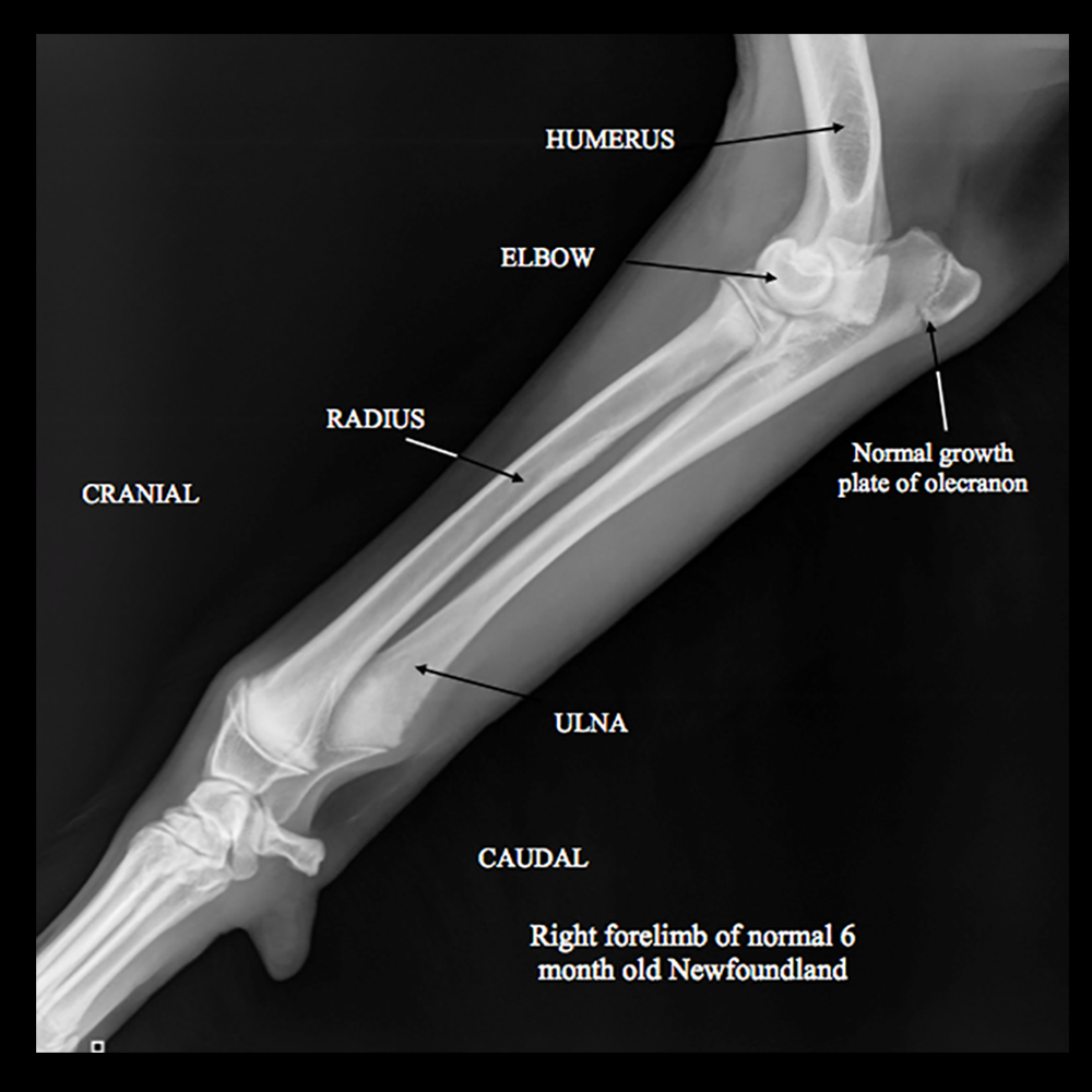 normal humerus x ray growth plates